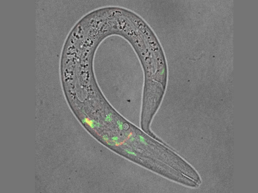 Somatostatin, Schlaf und die kleine Zelle, die über Gedächtnis und Alter entscheidet Mikroskopische Aufnahme des Fadenwurms C. elegans.