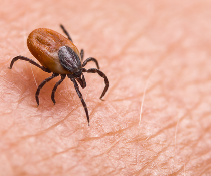 FSME-Fälle steigen weiter - Zecken breiten sich jetzt ganzjährig aus Zecke in Großaufnahme, die über Haut krabbelt