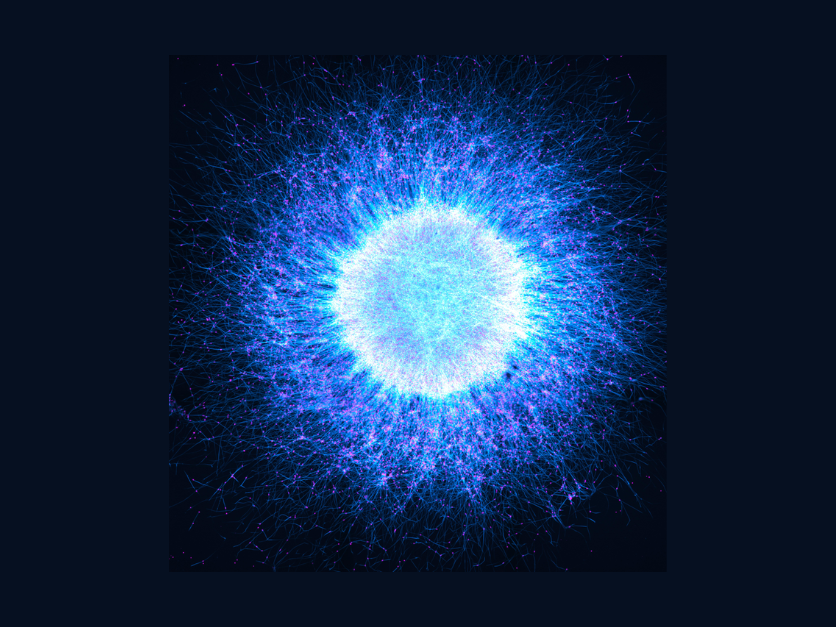 Globaler Gewinner Evident Image of the Year: Das Mikroskopie-Bild zeigt Neurosphären aus induzierten pluripotenten Stammzellen. Aufgenommen von Katie Holden aus Großbritannien. Gewinner des Wettbewerbs Image of the Year in der Kategorie Globaler Gewinner: Das Mikroskopie-Bild zeigt Neurosphären aus induzierten pluripotenten Stammzellen. Aufgenommen von Katie Holden aus Großbritannien.