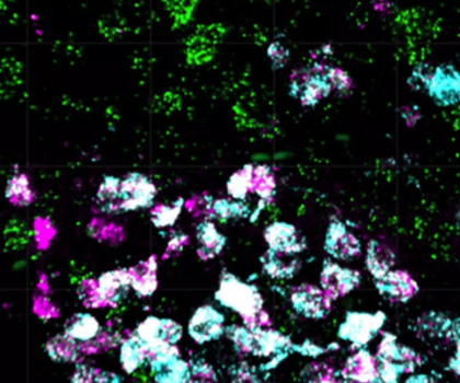 Nervenzellen im Hypothalamus - sie steuern Essverhalten und Gewicht Nervenzellen im Hypothalamus - sie steuern Essverhalten und Gewicht