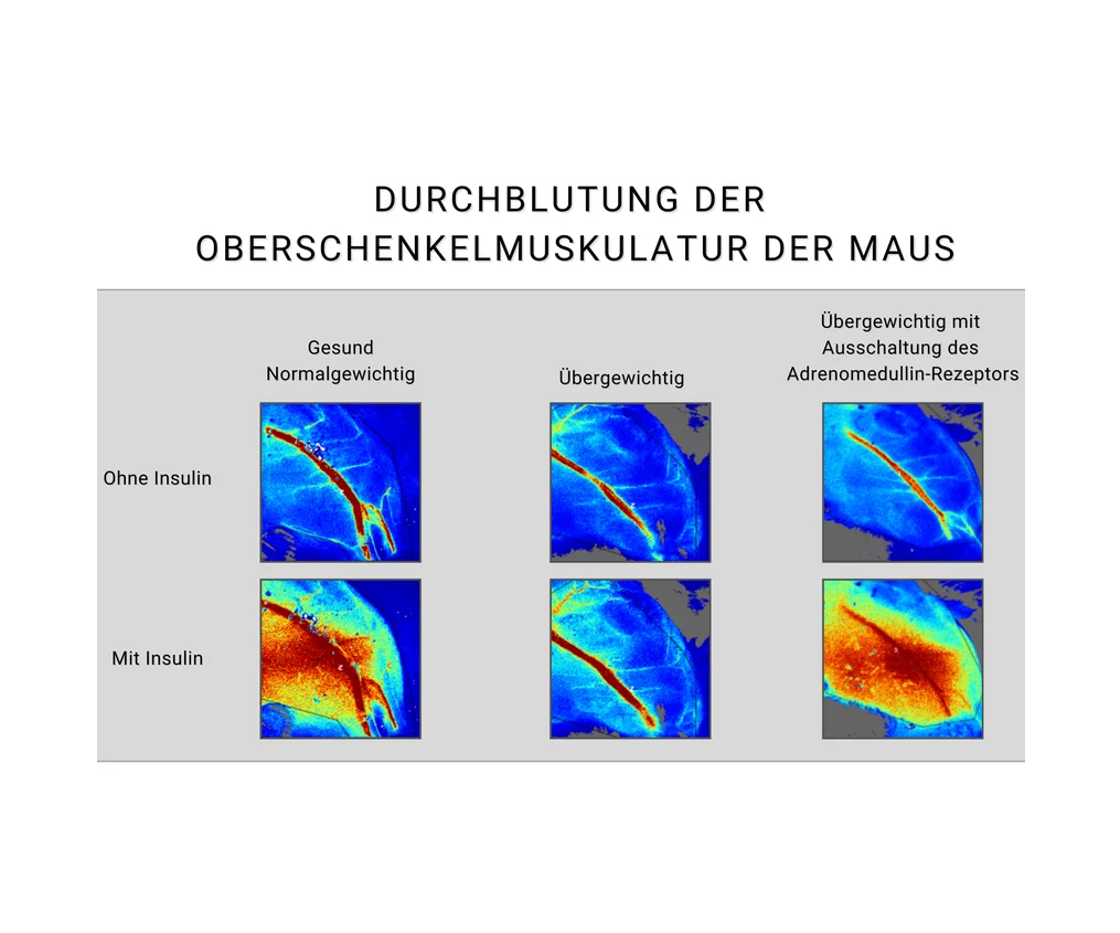 Hormon bei Übergewicht Diabetes verursacht Darstellung der Insulinwirkung am Endothel der Blutgefäße