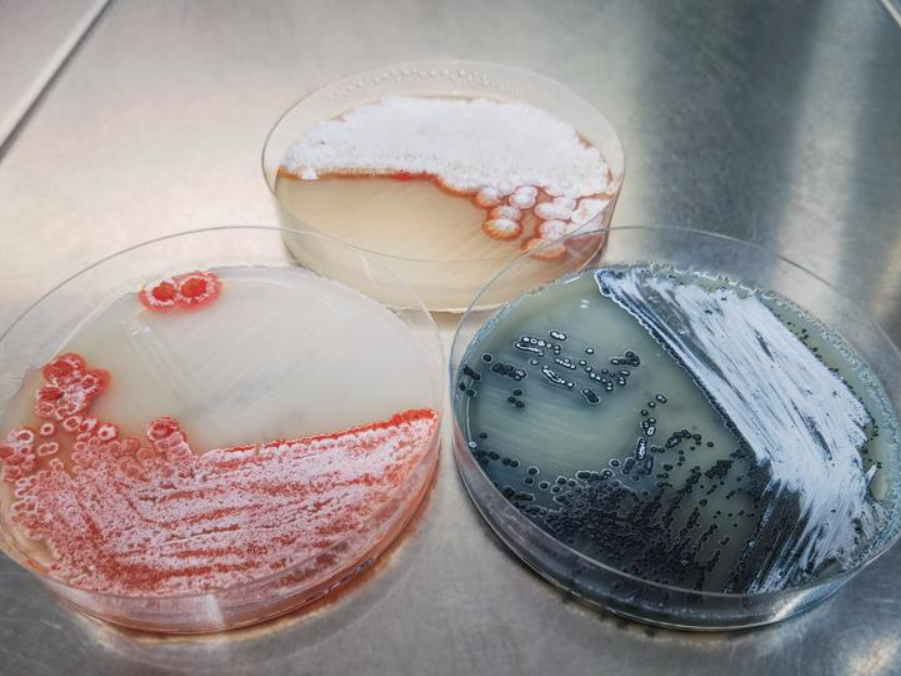 Kulturen unterschiedlicher Streptomyces-Stämme Kulturen von drei unterschiedlichen Streptomyces-Stämme in Petrischalen