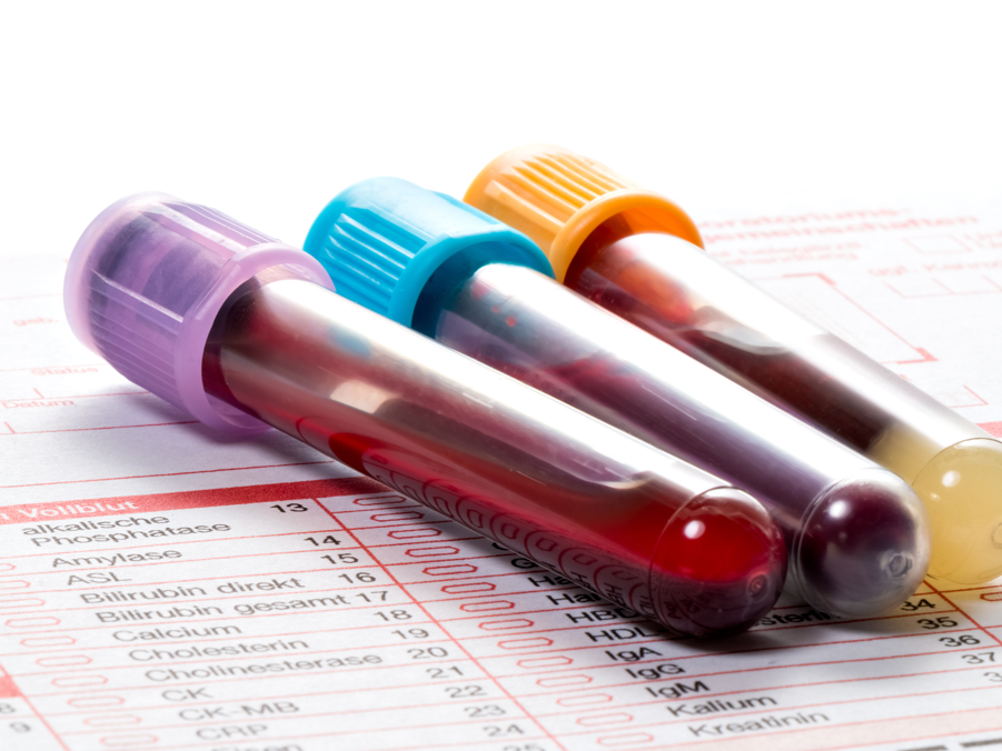 ADPKD: Einfacher Bluttest erkennt Verlauf von Nierenerkrankungen frühzeitig Blutproben mit einem Anforderungszettel für das Labor