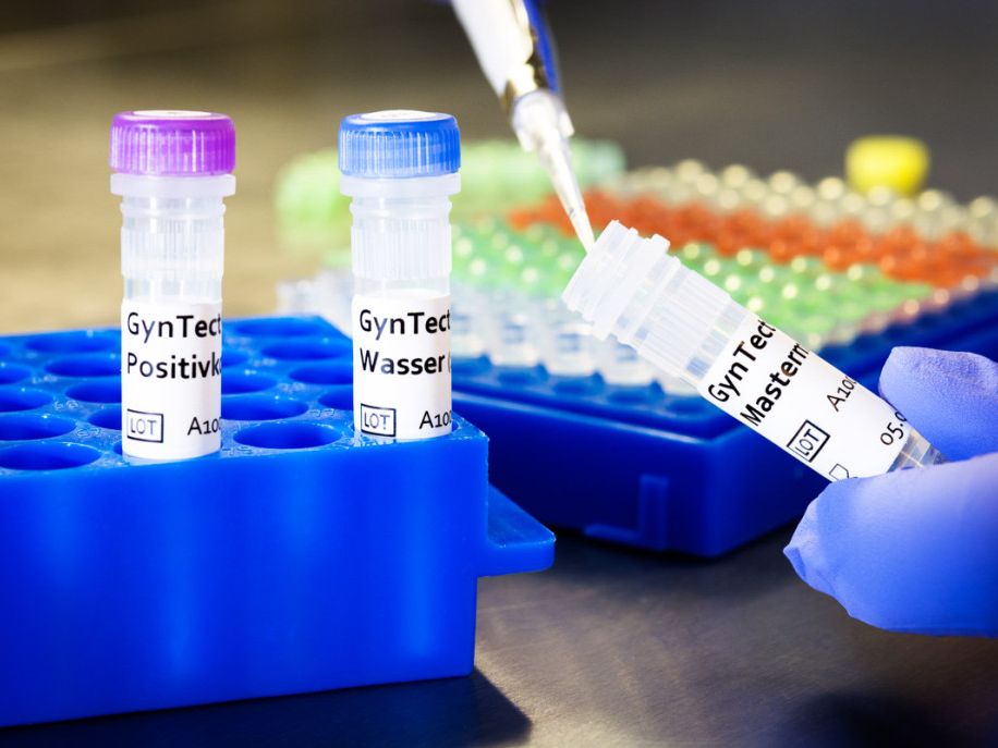 Komponenten des Tests „GynTect“ Komponenten des Tests „GynTect“
