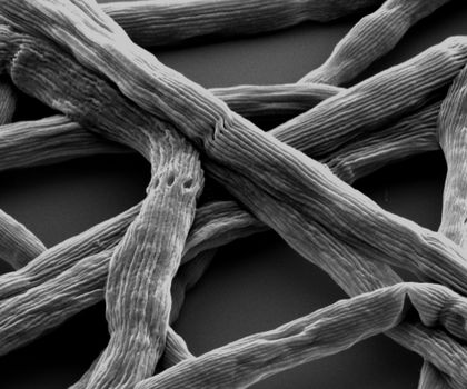 Kabelbakterium Electronema - lebender Stromleiter: Mikrobe des Jahres 2024