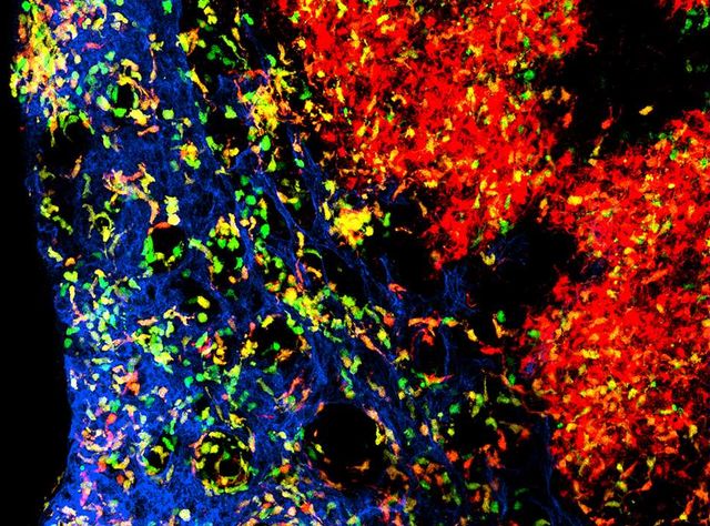 Immunologie: Was dendritische Zellen im Verbund hält Dendritische Zellen im Lymphknoten