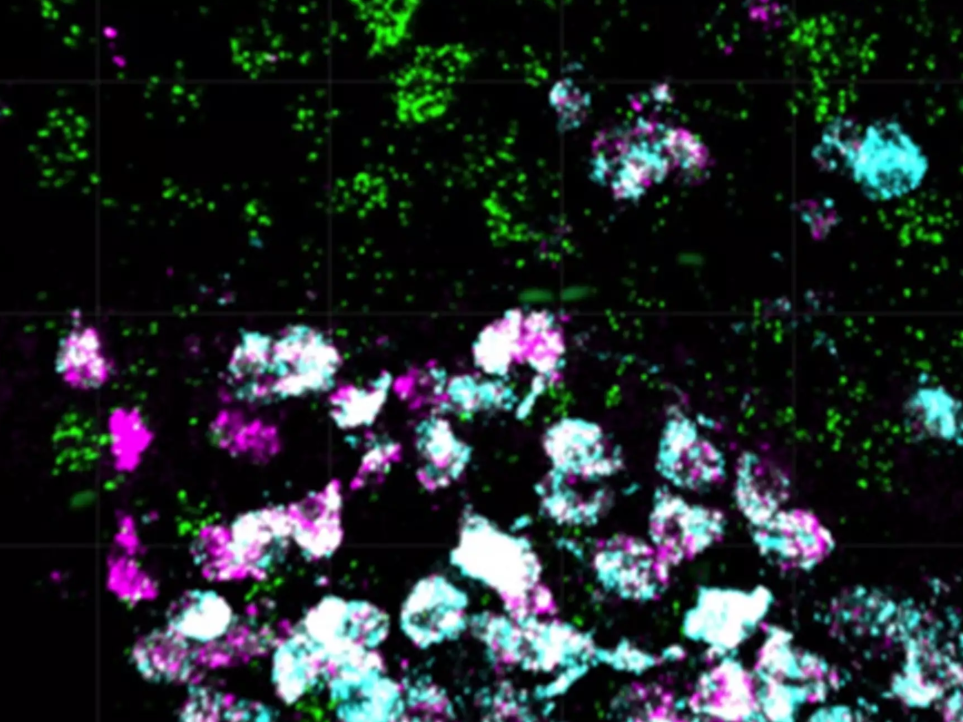 Nervenzellen im Hypothalamus - sie steuern Essverhalten und Gewicht