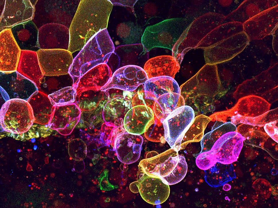Ehrenhaft erwähnt im Wettbewerb Image of the Year wurde das Mikroskop-Bild 'Absterbende oberflächliche Epithelzellen unter osmotischem Stress'. Aufgenommen von Yue Rong Tan (Taiwan).