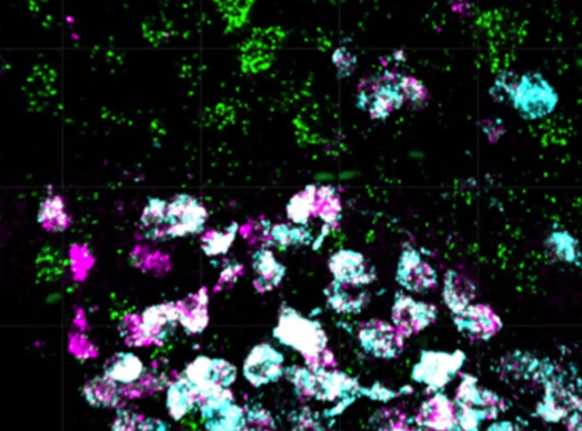 Nervenzellen im Hypothalamus - sie steuern Essverhalten und Gewicht Nervenzellen im Hypothalamus - sie steuern Essverhalten und Gewicht