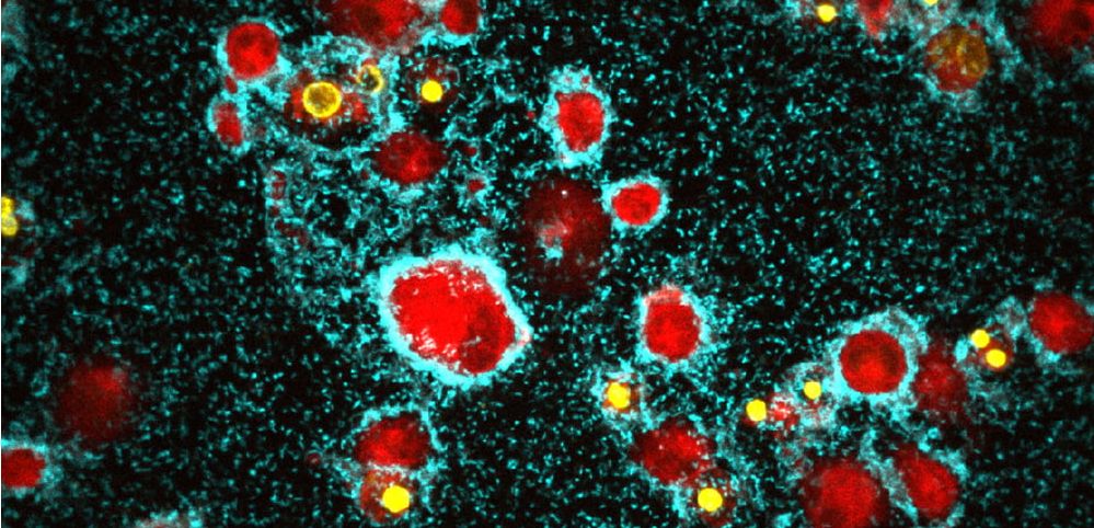 Bakteriologie: Neuartiger, aggressiver Biofilm auf Immunzellen entdeckt Vibrio cholerae bildet einen Biofilm