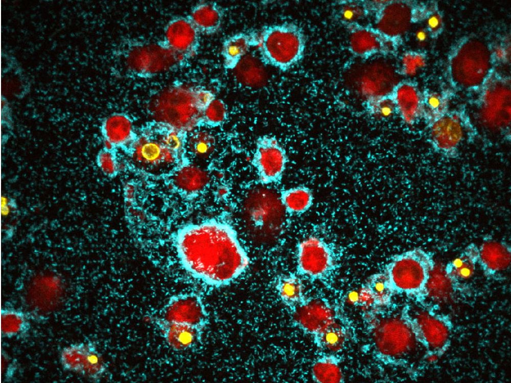 Vibrio cholerae bildet einen Biofilm