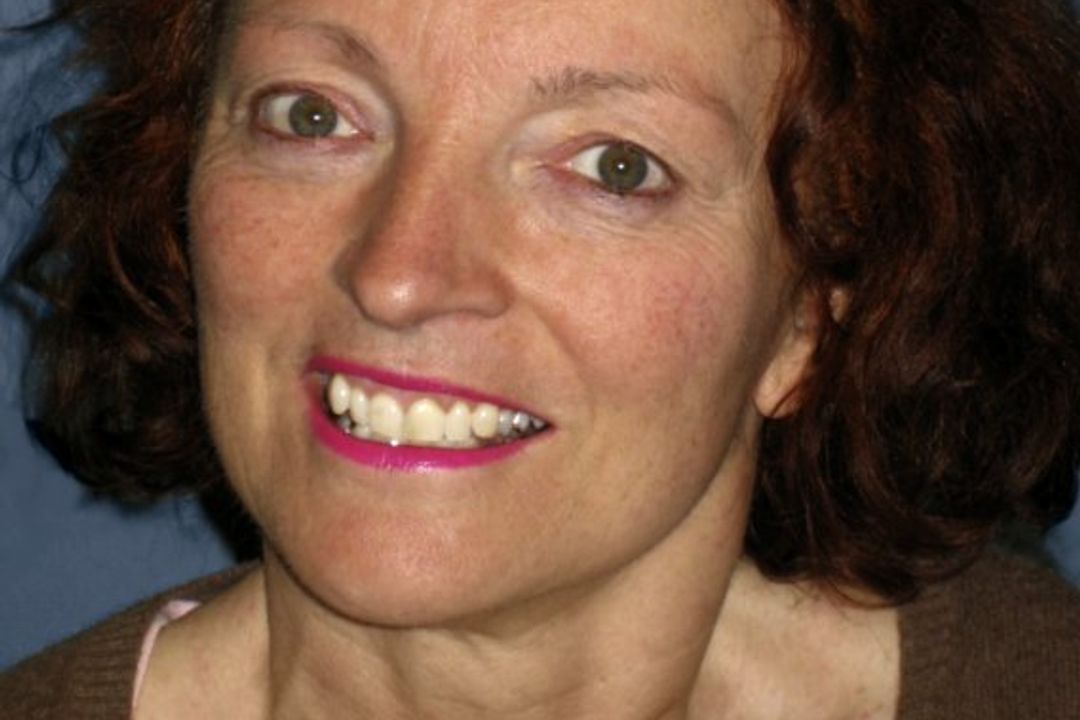 Der Assistenzroboter mit Namen 'Friend' Der Assistenzroboter mit Namen 'Friend'
