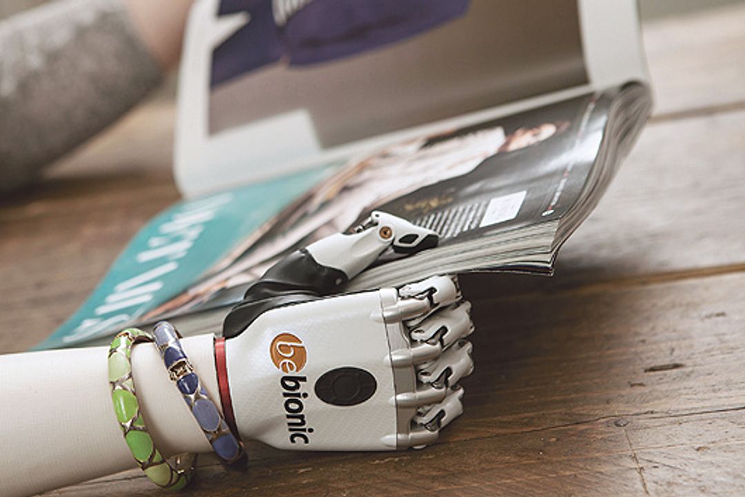 Mensch mit Arm- und Handprothese Mensch mit Arm- und Handprothese