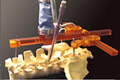 SpineAssist von Mazor Surgical Technologies SpineAssist von Mazor Surgical Technologies