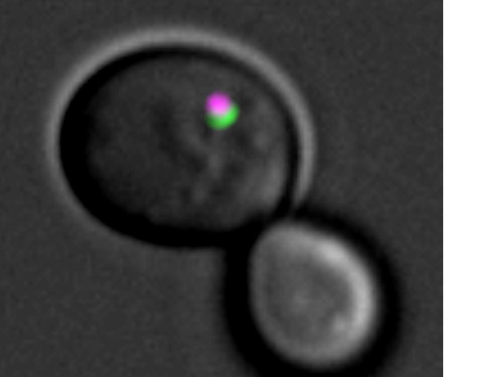 In einer Hefezelle wird der Zellabfall  von Autophagosomenmembranen eingehüllt.