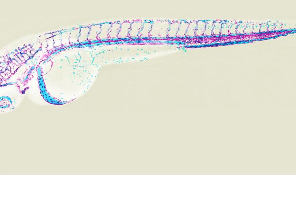 Blutgefäßsystem in einem zwei Tage alten Zebrafischembryo (magenta: Endothelzellen, hellblau: Blutzellen).