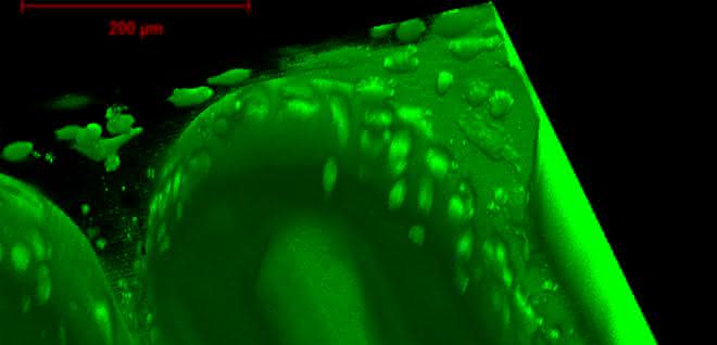 Bio-Trennwand aus dem 3D-Drucker: Die künstliche Plazenta im Labor Winzige Strukturen aus bio-kompatiblem Material können im speziellen 3D-Drucker an der TU Wien hergestellt werden. Darauf siedeln sich dann Zellen an.