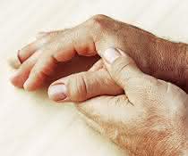 Immunologie: Schlüsselrolle von ILC2 bei der Entstehung entzündlicher Arthritis