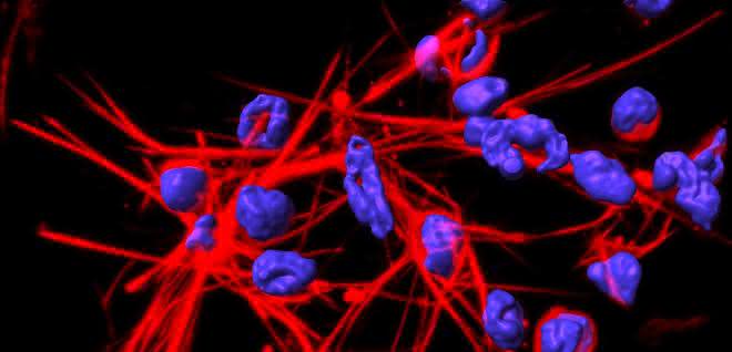 DNA-Netze, die von Neutrophilen aufgestellt werden.