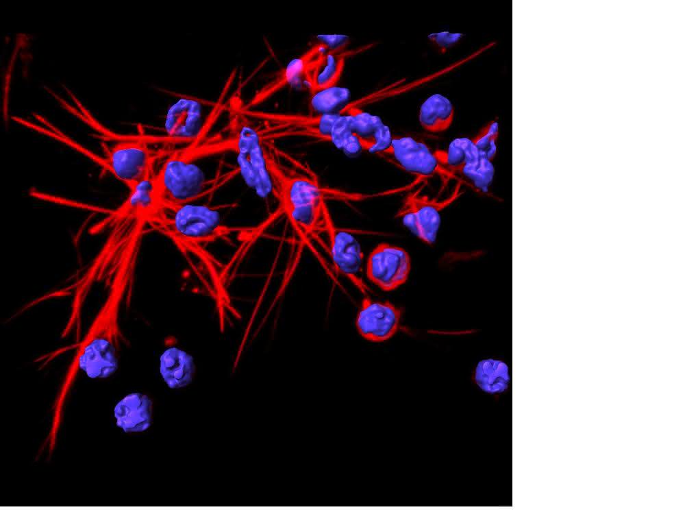 DNA-Netze, die von Neutrophilen aufgestellt werden.