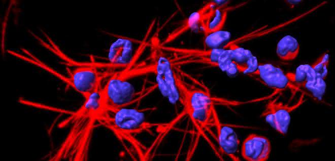 Immunabwehr und Mitochondrien: Im Kampf gegen Bakterien braucht es genügend Energie DNA-Netze, die von Neutrophilen aufgestellt werden.