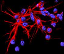 Immunabwehr und Mitochondrien: Im Kampf gegen Bakterien braucht es genügend Energie DNA-Netze, die von Neutrophilen aufgestellt werden.