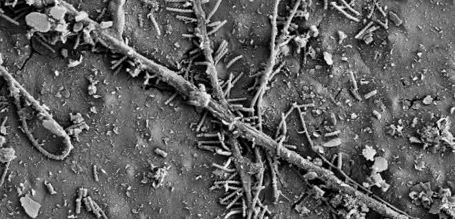 Mikrobiologie: Mikroorganismen können Plastik im Boden zersetzen