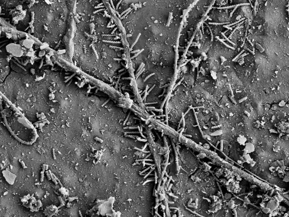 Mikrobiologie: Mikroorganismen können Plastik im Boden zersetzen