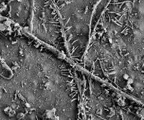 Mikrobiologie: Mikroorganismen können Plastik im Boden zersetzen Mikrobiologie: Mikroorganismen können Plastik im Boden zersetzen