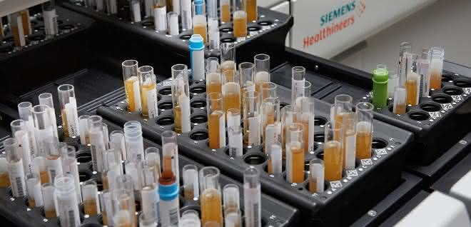 Das Analysesystem Atellica Solution für klinische Chemie und Immunologie von Siemens Healthineers automatisiert klinische und operative Abläufe. (Bild: Siemens Healthineers) Das Analysesystem Atellica Solution für klinische Chemie und Immunologie von Siemens Healthineers automatisiert klinische und operative Abläufe. (Bild: Siemens Healthineers)