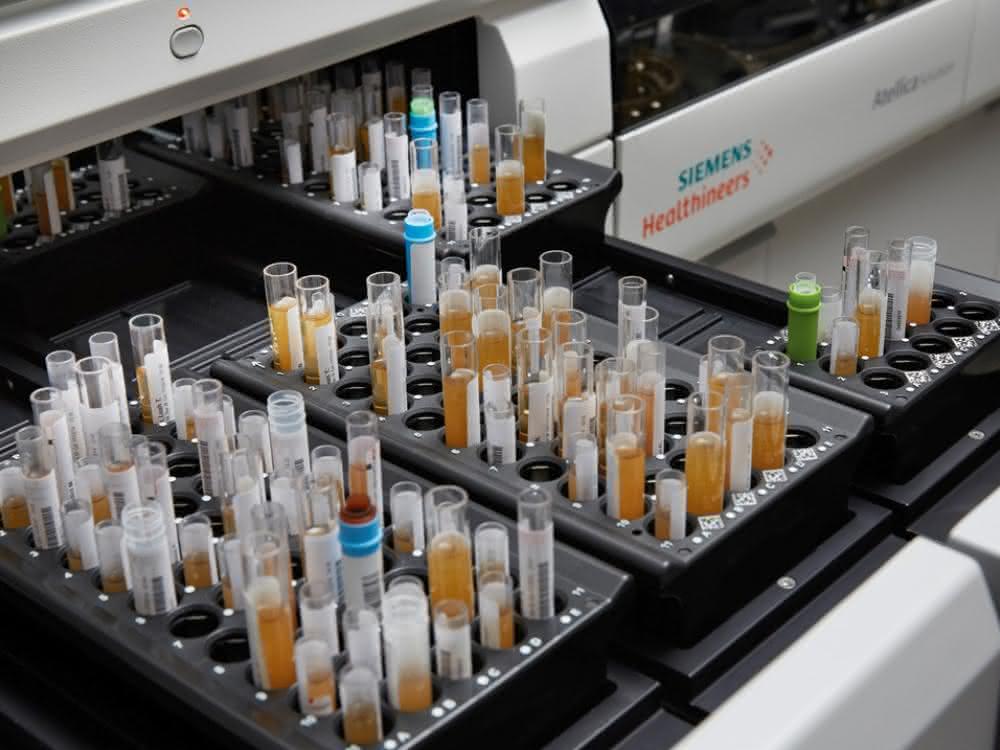 Das Analysesystem Atellica Solution für klinische Chemie und Immunologie von Siemens Healthineers automatisiert klinische und operative Abläufe. (Bild: Siemens Healthineers)