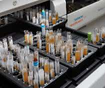 Das Analysesystem Atellica Solution für klinische Chemie und Immunologie von Siemens Healthineers automatisiert klinische und operative Abläufe. (Bild: Siemens Healthineers) Das Analysesystem Atellica Solution für klinische Chemie und Immunologie von Siemens Healthineers automatisiert klinische und operative Abläufe. (Bild: Siemens Healthineers)