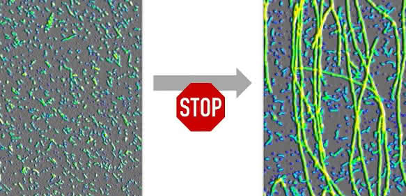 Oligomere (links) verhindern aktiv, dass sie zu Fibrillen (Fäden im rechten Bild) abgebaut werden. (Bild: Wolfgang Hoyer/HHU) Oligomere (links) verhindern aktiv, dass sie zu Fibrillen (Fäden im rechten Bild) abgebaut werden. (Bild: Wolfgang Hoyer/HHU)