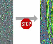 Oligomere (links) verhindern aktiv, dass sie zu Fibrillen (Fäden im rechten Bild) abgebaut werden. (Bild: Wolfgang Hoyer/HHU) Oligomere (links) verhindern aktiv, dass sie zu Fibrillen (Fäden im rechten Bild) abgebaut werden. (Bild: Wolfgang Hoyer/HHU)