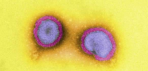 Influenza-Viren (Bild: K. Boller/PEI)