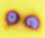 Influenza-Viren (Bild: K. Boller/PEI)