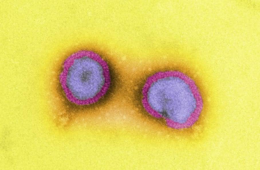 Influenza-Viren (Bild: K. Boller/PEI)