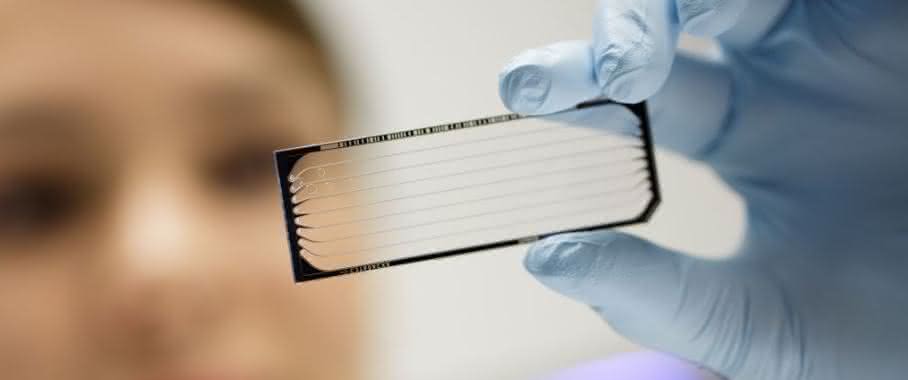 Mittels moderner Hochdurchsatzsequenzierung entdeckten NCT-Wissenschaftler eine therapeutisch relevante Besonderheit im genetischen Code von Bauchspeicheldrüsenkrebs. (Bild: NCT / Philip Benjamin“) Hochdurchsatzsequenzierung