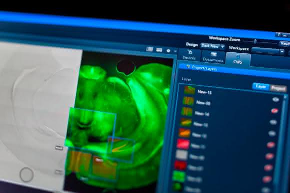 Screenshot der Software Zeiss Zen Connect.