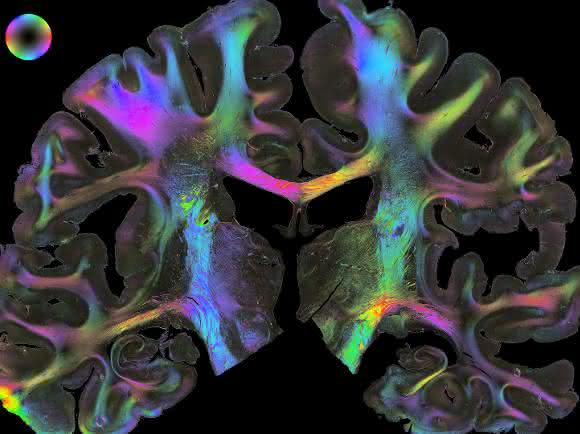 Eine zentrale Bedeutung kommt den Verbindungen zwischen Hirnarealen zu: Die Forscher durchleuchten Gewebeschnitte mit polarisiertem Licht (Polarized Light imaging), um Nervenfaserbahnen sichtbar zu machen. Entsprechend ihrer Raumrichtung lassen sich die Fasern in verschiedenen Farben anzeigen (Bild: Forschungszentrum Jülich/Markus Axer) Eine zentrale Bedeutung kommt den Verbindungen zwischen Hirnarealen zu: Die Forscher durchleuchten Gewebeschnitte mit polarisiertem Licht (Polarized Light imaging), um Nervenfaserbahnen sichtbar zu machen. Entsprechend ihrer Raumrichtung lassen sich die Fasern in verschiedenen Farben anzeigen (Bild: Forschungszentrum Jülich/Markus Axer)