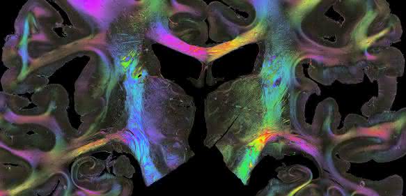 Eine zentrale Bedeutung kommt den Verbindungen zwischen Hirnarealen zu: Die Forscher durchleuchten Gewebeschnitte mit polarisiertem Licht (Polarized Light imaging), um Nervenfaserbahnen sichtbar zu machen. Entsprechend ihrer Raumrichtung lassen sich die Fasern in verschiedenen Farben anzeigen (Bild: Forschungszentrum Jülich/Markus Axer)