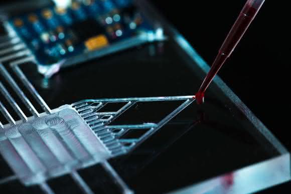 Lab-on-a-Chip