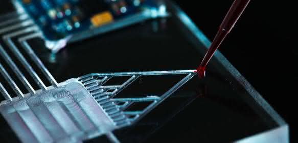 Lab-on-a-Chip