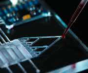 Lab-on-a-Chip