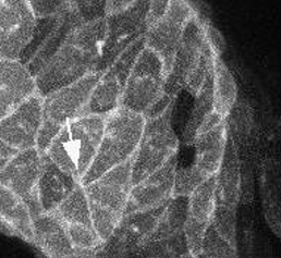 Mikroskopische Aufnahme von Herzzellen eines Zebrafischembryos