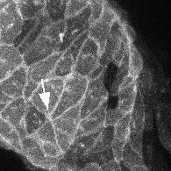 Herzzellen eines Zebrafischembryos finden neu zueinander. ... Mikroskopische Aufnahme von Herzzellen eines Zebrafischembryos