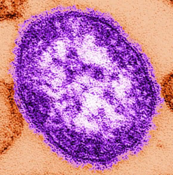 Masernvirus (Bild: C. Goldsmith, W. Bellini / CDC)