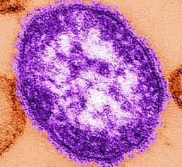 Masernvirus (Bild: C. Goldsmith, W. Bellini / CDC)
