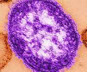 Masernvirus (Bild: C. Goldsmith, W. Bellini / CDC)