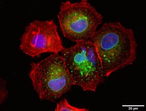 Die Brustkrebs-Zelllinie MCF7 produziert das Mikroprotein CASIMO1 (grün). Rot dargestellt ist das Zellskelett-Protein Aktin, blau die Zellkerne. (Bild: M. Polycarpou-Schwarz; S. Diederichs, DKFZ) Mikroskopische Aufnahme: Brustkrebs-Zelllinie MCF7 produziert Mikroprotein CASIMO1